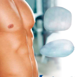 PowerFlex™ – Implantes pectorales para volumen y definición masculina